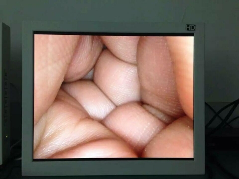 15寸醫(yī)療顯示器